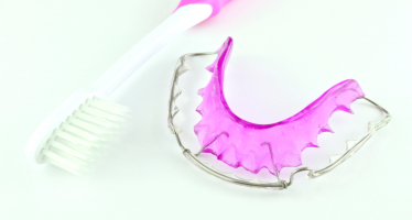 The Next Step in Your Orthodontic Journey: A Retainer